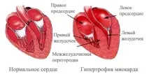 Занятія кроссфітом кросфіті