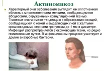 актиномикоза възпалителни