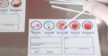 Архіви Групи крові групи