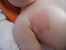 снимка снимка