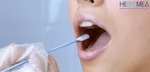 анализ отслабване