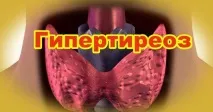 залози