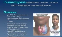 гіпертиреоз