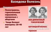 симптоми