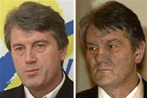 Клінічний аналіз крові лімфоцити підвищені, відповіді лікарів, консультація лімфоцити
