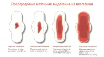 Лохії після пологів та кесарева (їх тривалість) після
