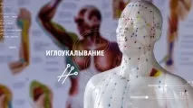 Лікування методами східної медицини східної