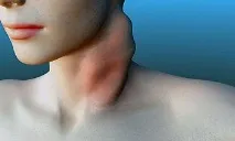 лечение средства