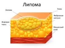 какви гърдата
