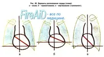 Анатомія Положення серця положення