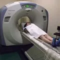 gbsmp неврохирургично