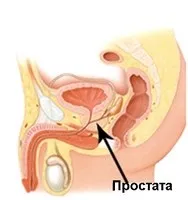 простата