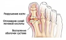 особливість