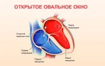 сърцето възрастен