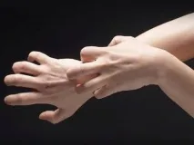 симптоми лечение