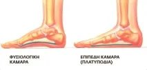 плоскостъпие върху цялото