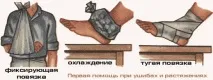 Перша допомога при розтягуванні м’язів допомога