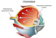 подходи болестта