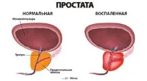 употреба простата
