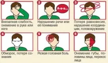 мъже микроинсулт
