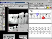 Програма для стоматології Dental4Windows (D4W) dental4windows