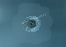 розшарування