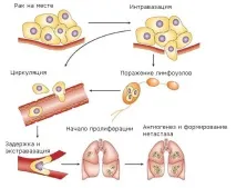Рак печінки з метастазами, скільки живуть пацієнти Який рак дає метастази до печінки метастазами
