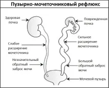 бъбреците бъбреците