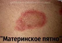 розов