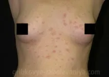 причини