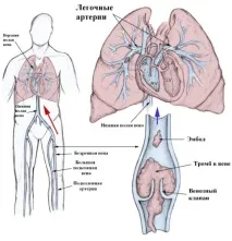 Згортання крові як відбувається, фактори, норма згортання