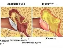 лечение лечение