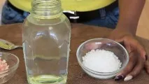 акне мицеларна