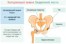 тазобедрената тазобедрената