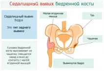 става става
