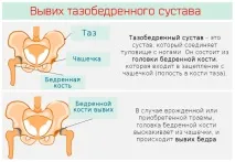тазобедрената тазобедрената