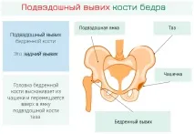 тазобедрената става
