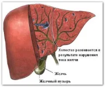 лечение