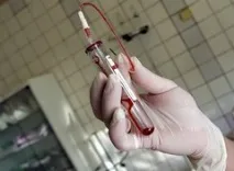 Аналіз на краснуху – свідчення, розшифрування результатів результатів