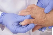 Поліартрит запалення