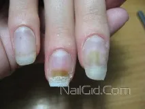 ногах