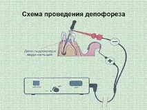 Ендодонтія протейпери, ендоінструменти, латеральна конденсація, депофорез, гутаперчеві штифти депофорез
