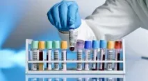 Гепатит У розшифровка маркерів захворювання захворювання