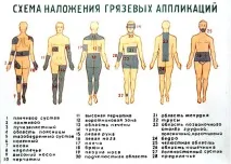 протипоказання