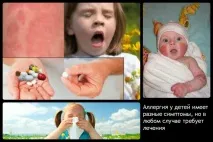 Які антигістамінні препарати краще підійдуть дитині краще
