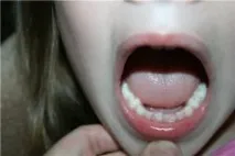 зъби зъби