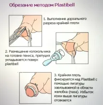 главата пениса главата пениса