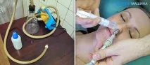 Зозуля при гаймориті як роблять і ефективність методу роблять