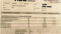 Лікування верблюжим молоком в Єгипті. лікування