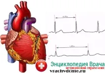 Брадикардія ознаки та народні методи лікування брадикардія